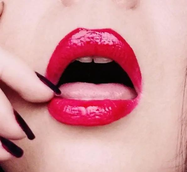 MissRed