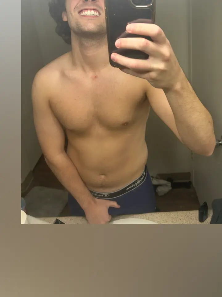 toplander